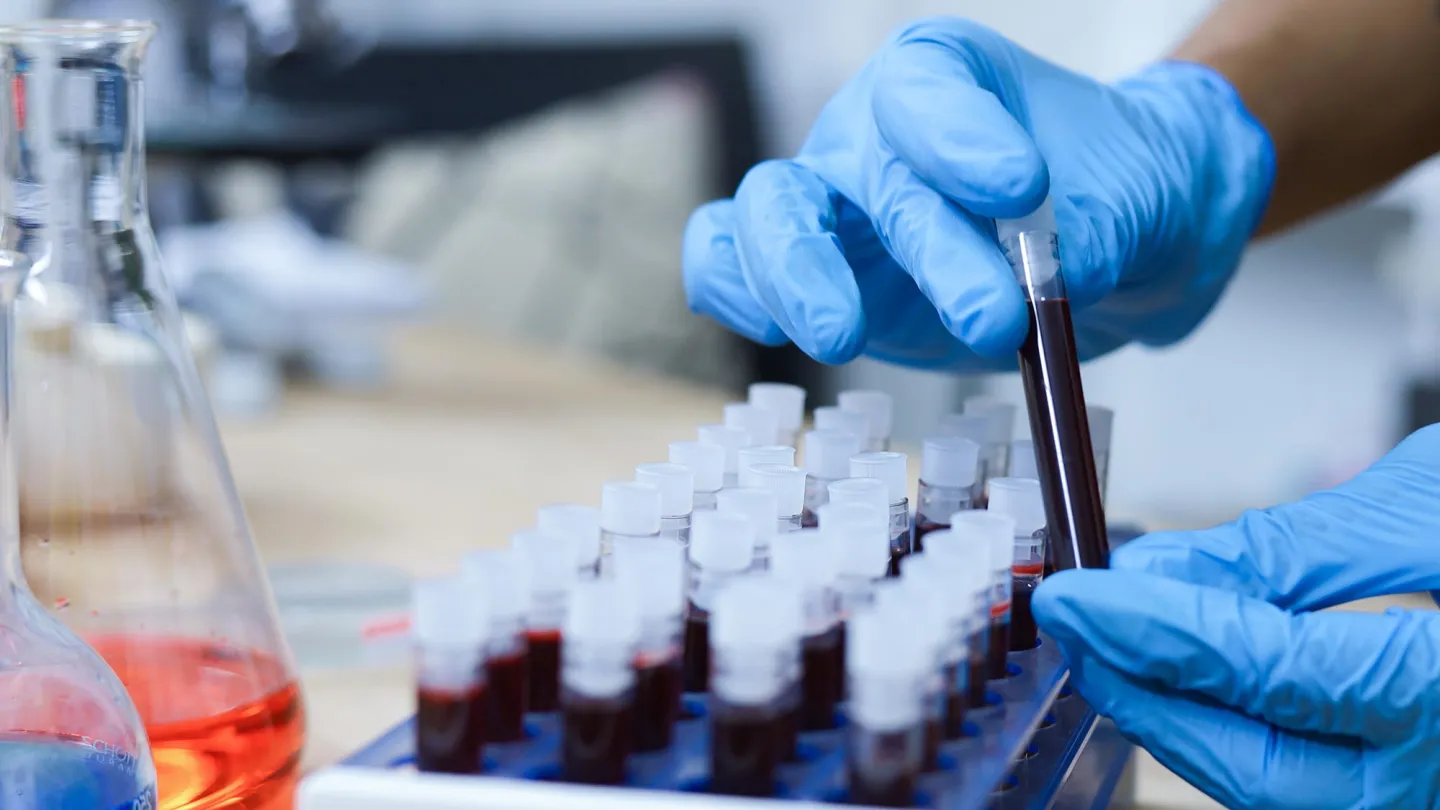 Blood research, Scientist hand holding test tube with blood in laboratory