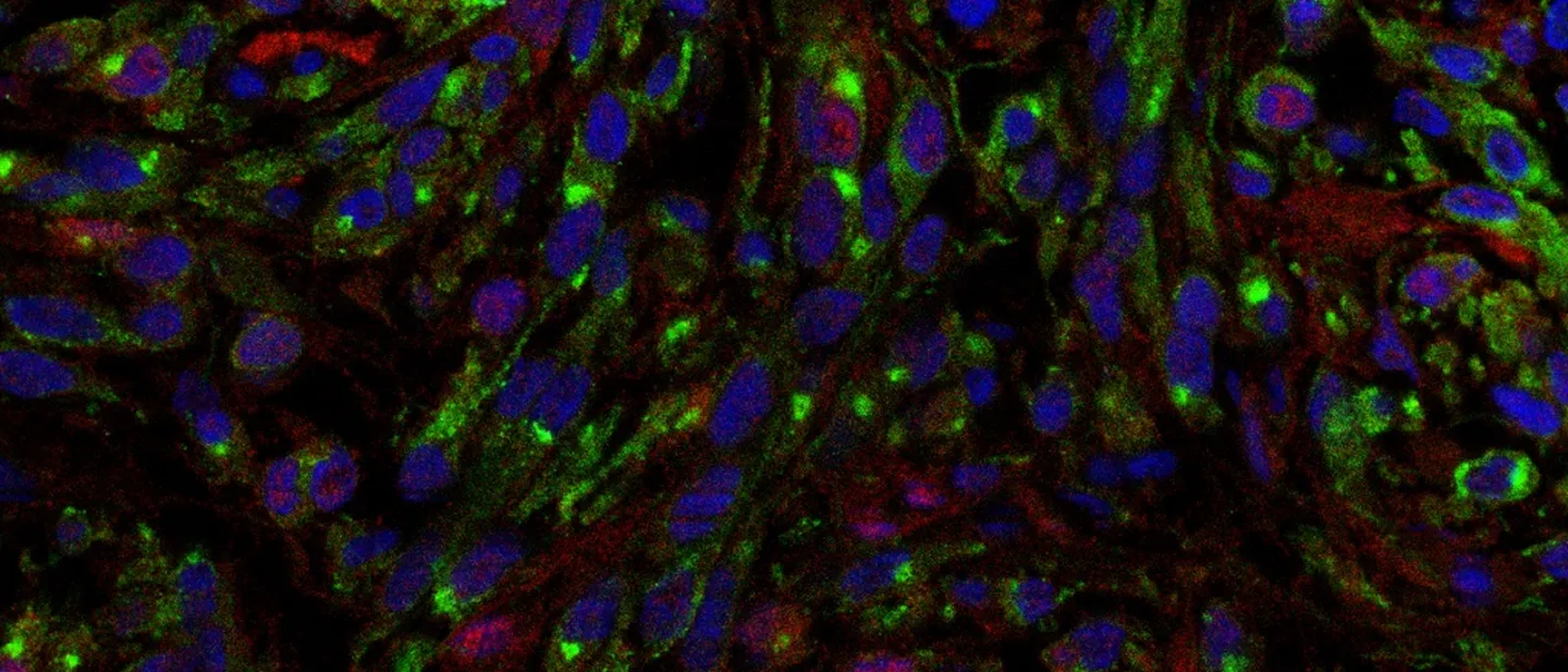 Cancer Dormancy Institute Service Core