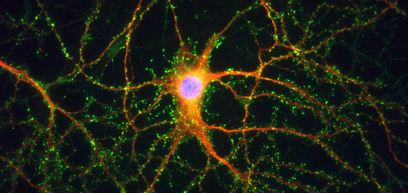 A graphic showing a neuron.