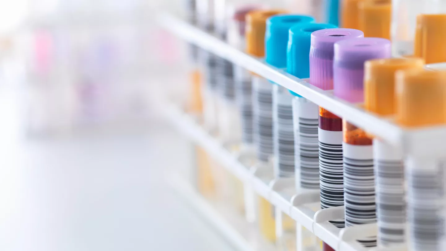 Colorful Test Tubes Banner