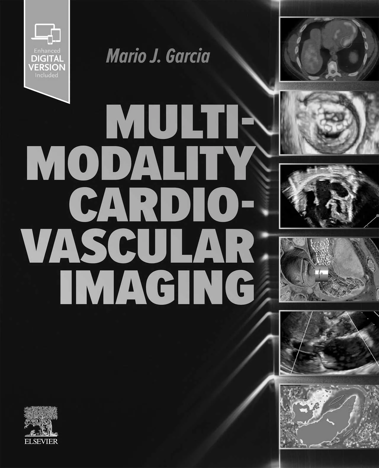 Multi-modality cardio-vascular imaging