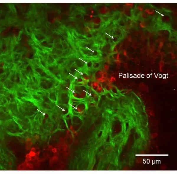 Newly discovered structures between the cornea and the sclera.