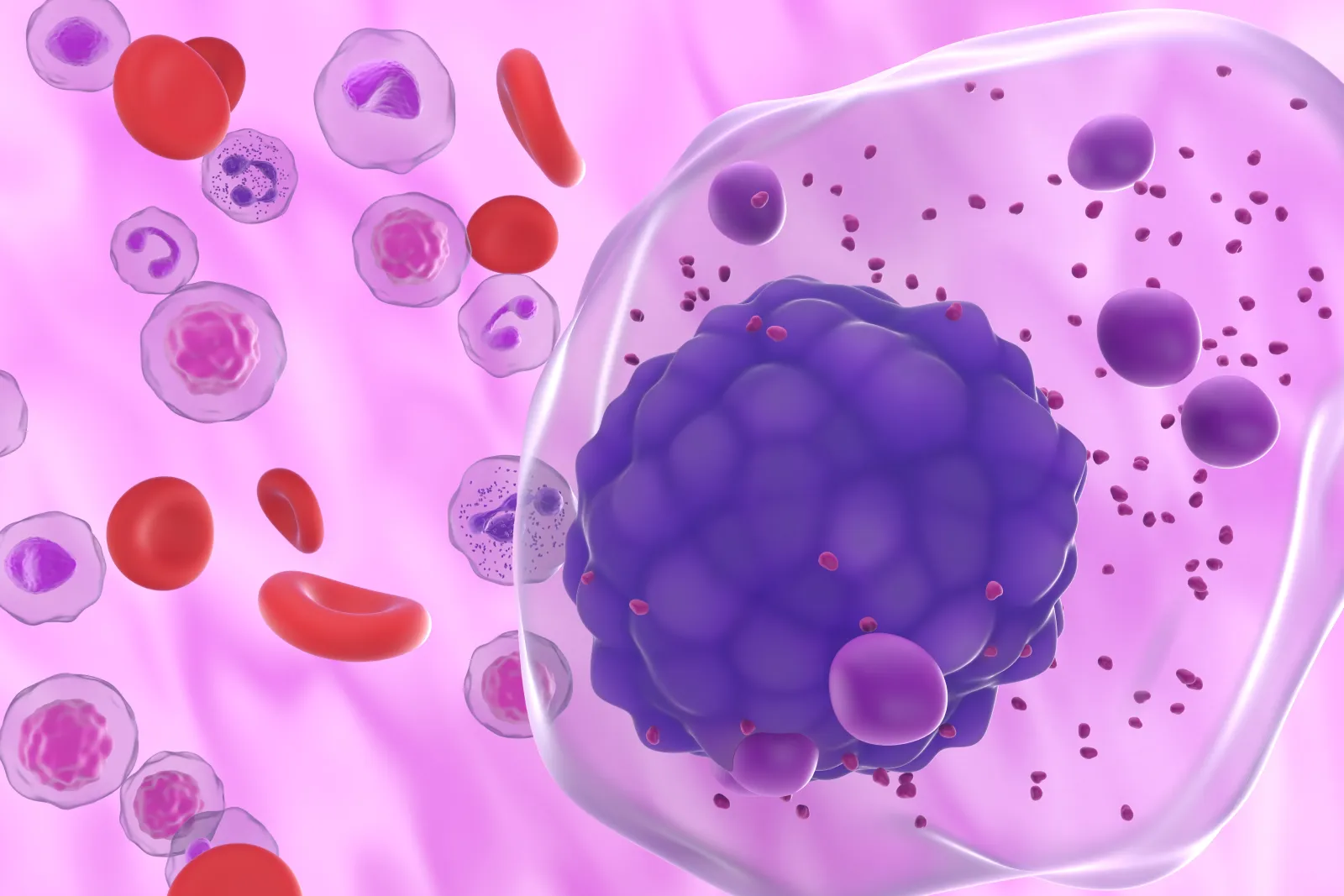 Shastri Blood Cancer Journal