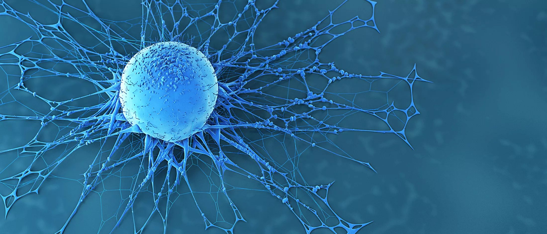 Illustration of a Human Cancer Cell