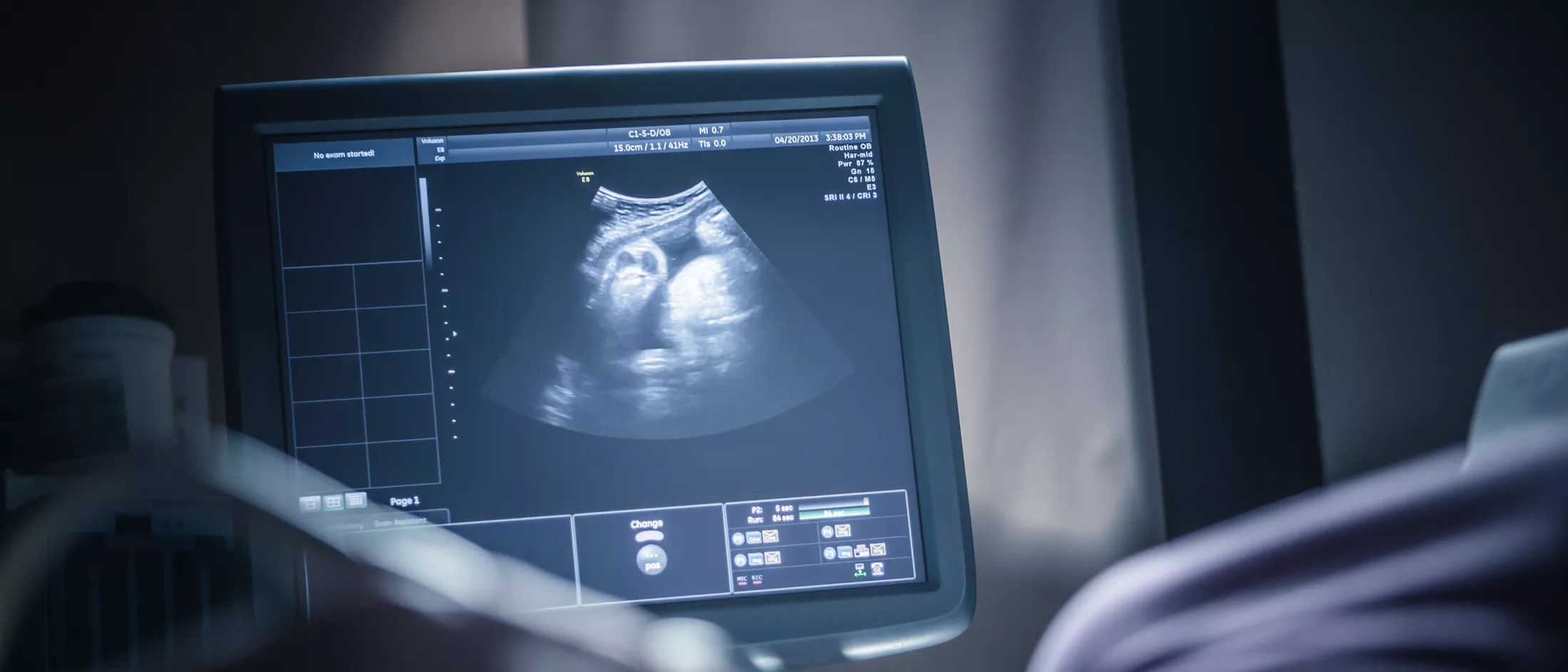 Pregnant woman receiving a sonogram