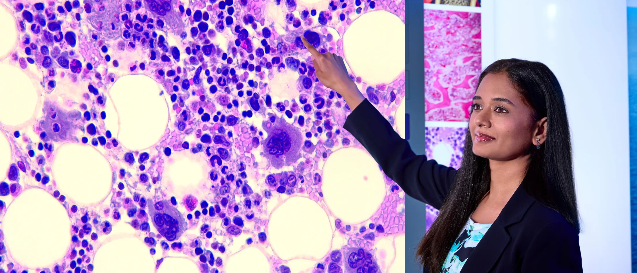 Woman in a blazer pointing at a brightly lit histology slide on a large screen.