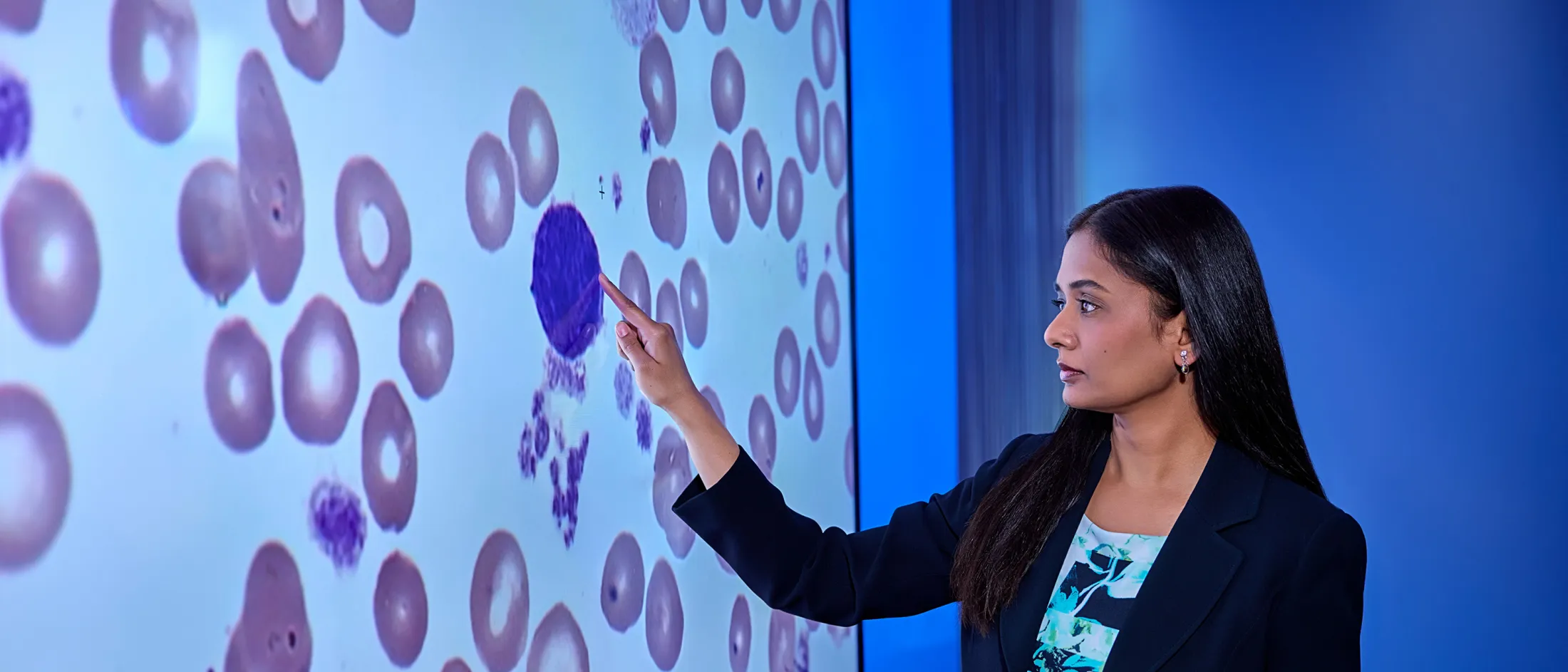 Woman in a blazer pointing at a magnified blood cell image on a large screen in a lab setting.