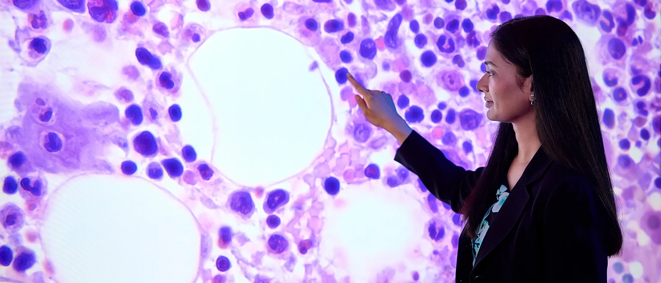 Researcher points at a magnified image of blood cells on a large digital display, demonstrating hematologic analysis.