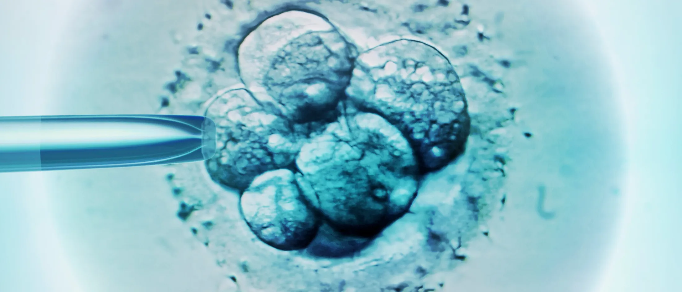 Microscopic view of an embryo being injected with a pipette during an in vitro fertilization procedure.