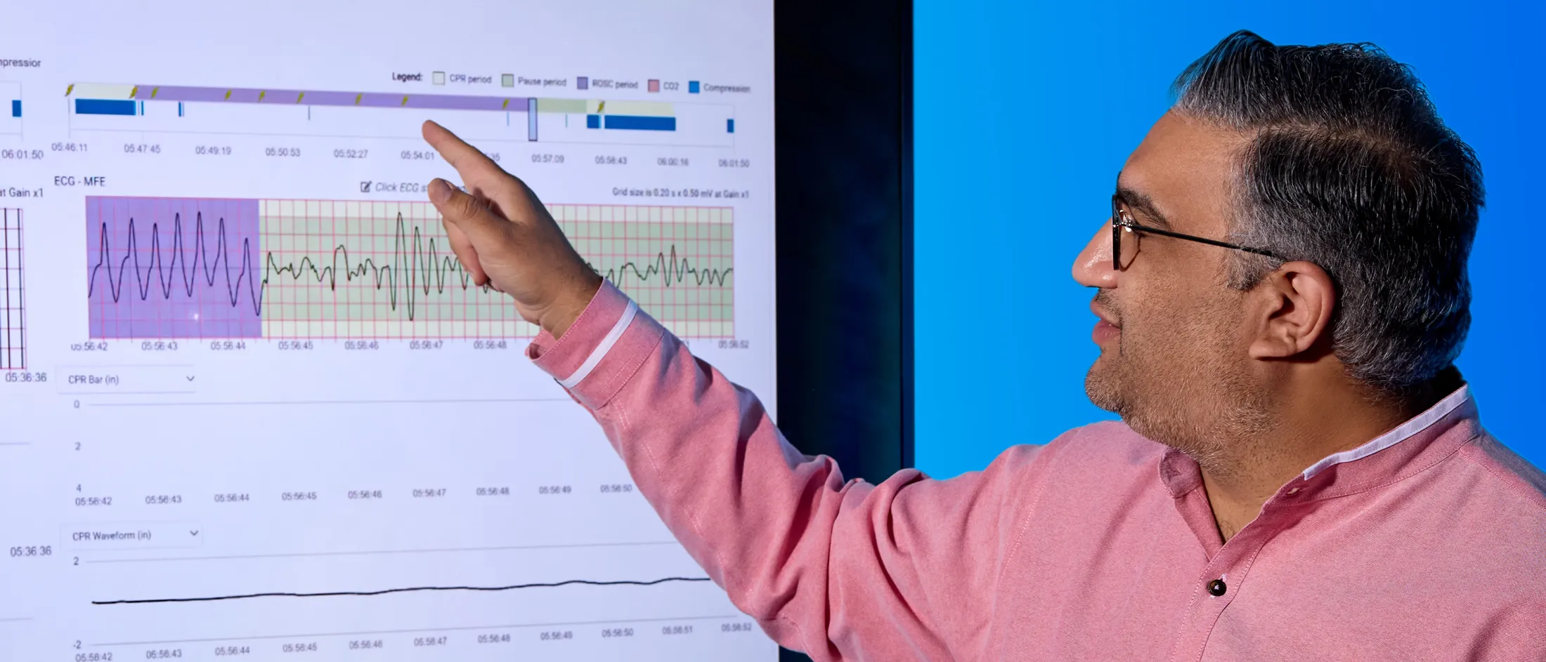 Man in a pink shirt explains cardiac rhythm data displayed on a large screen during a medical presentation.