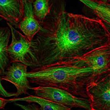 Magnetic resonance image. 