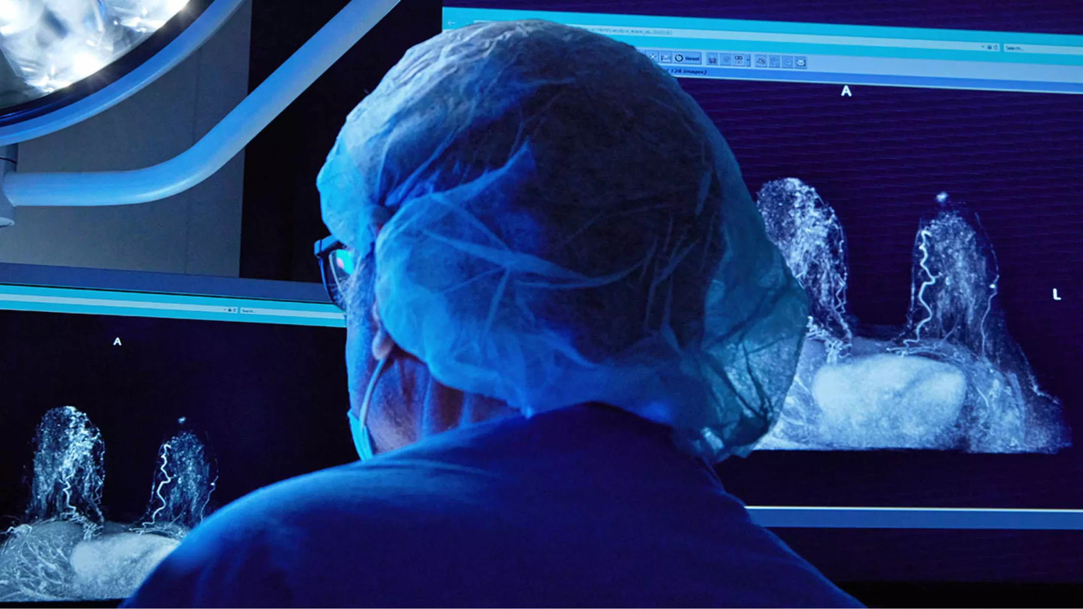 Doctor looking at breast x rays