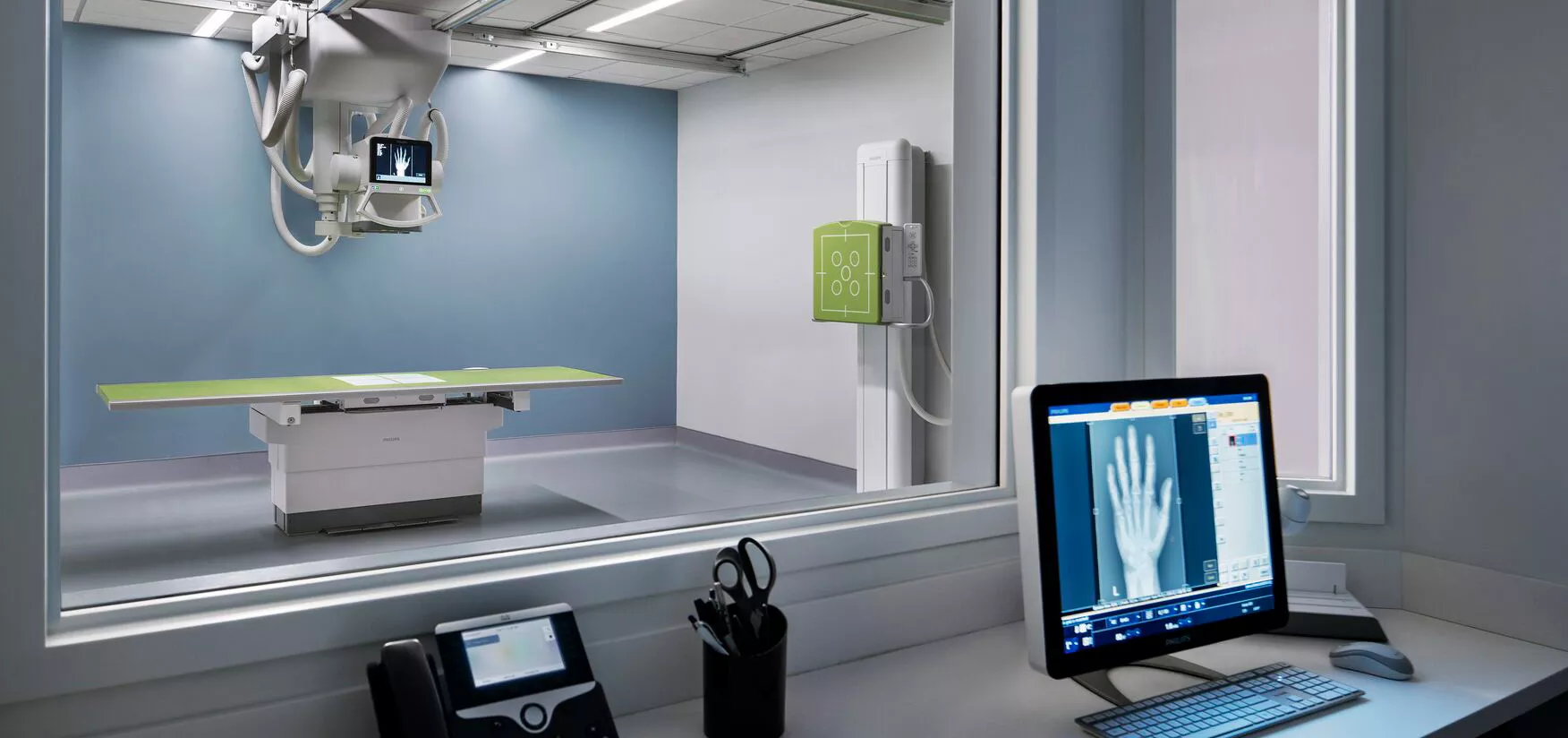 Photo of x-ray of hand on a computer screen