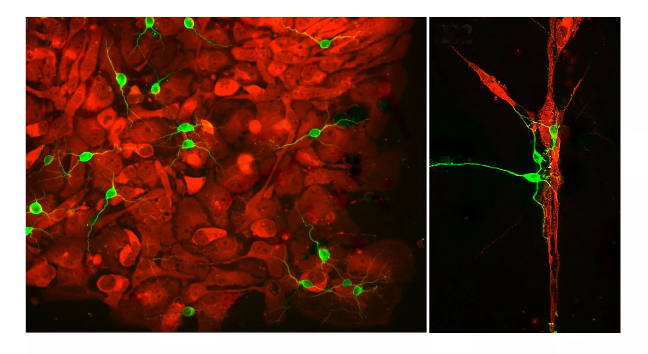 A graphic showing nerve damage