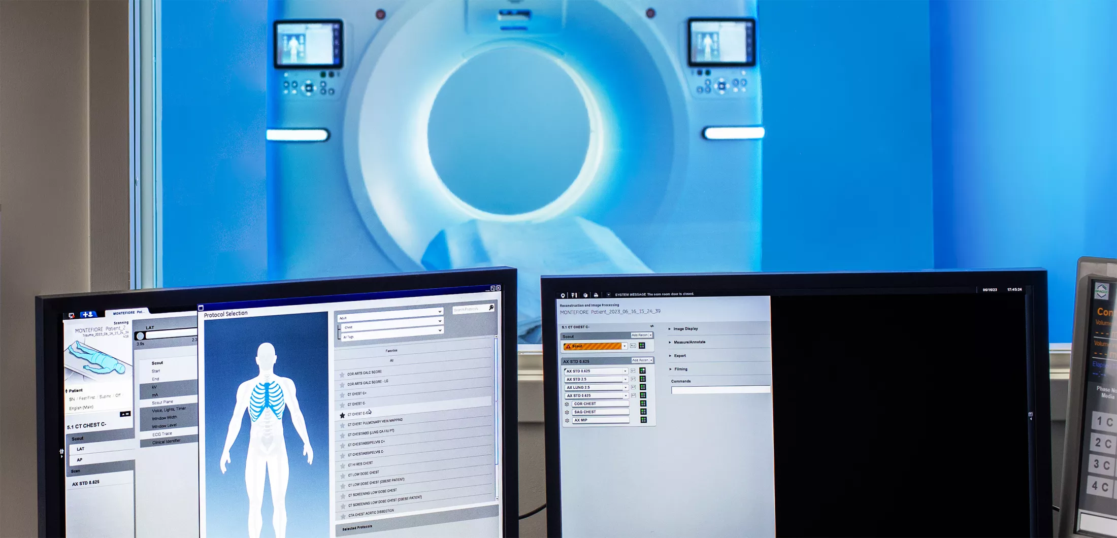 Computer monitors on a desk with a CT scanner behind them.