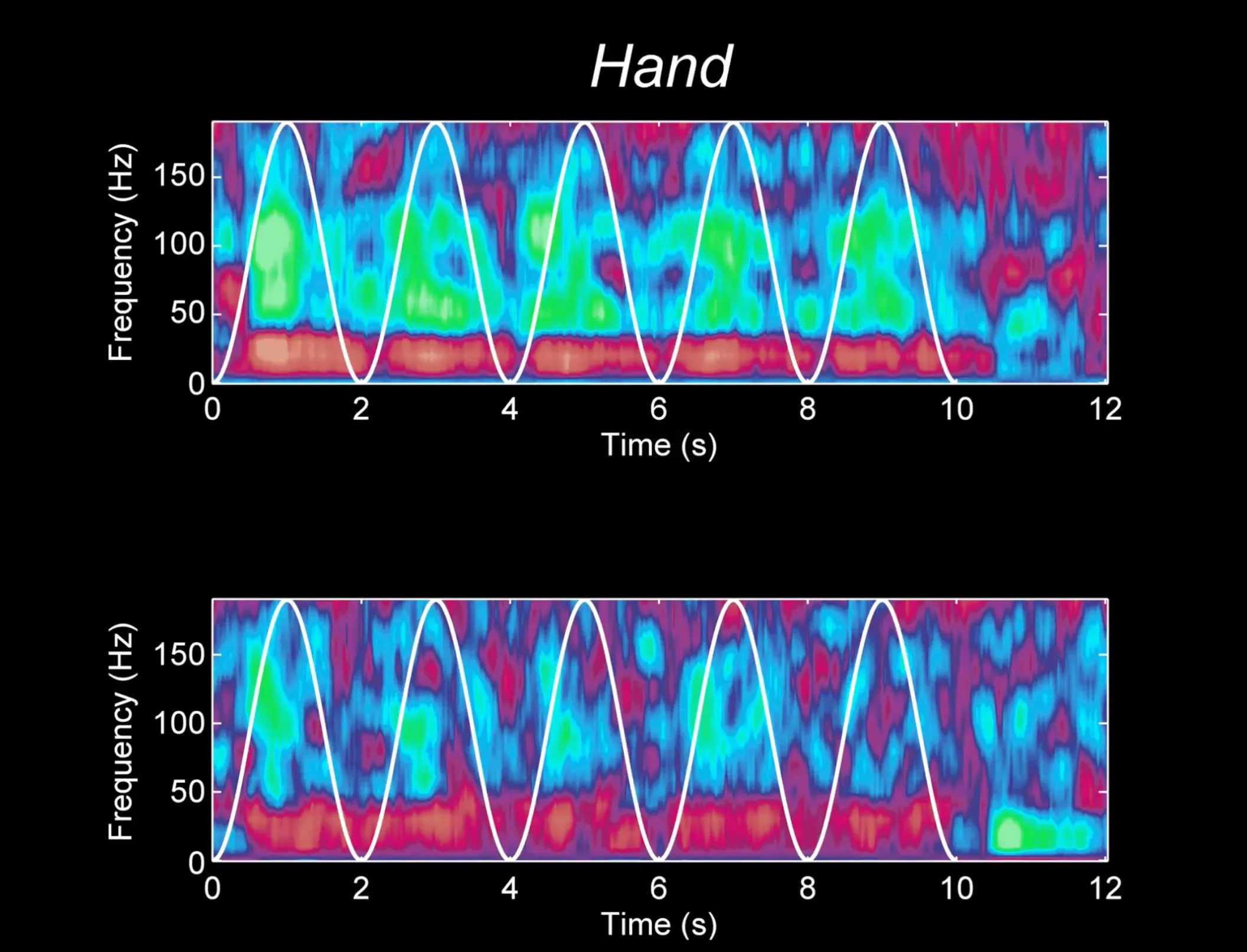 A chart of movement disorders