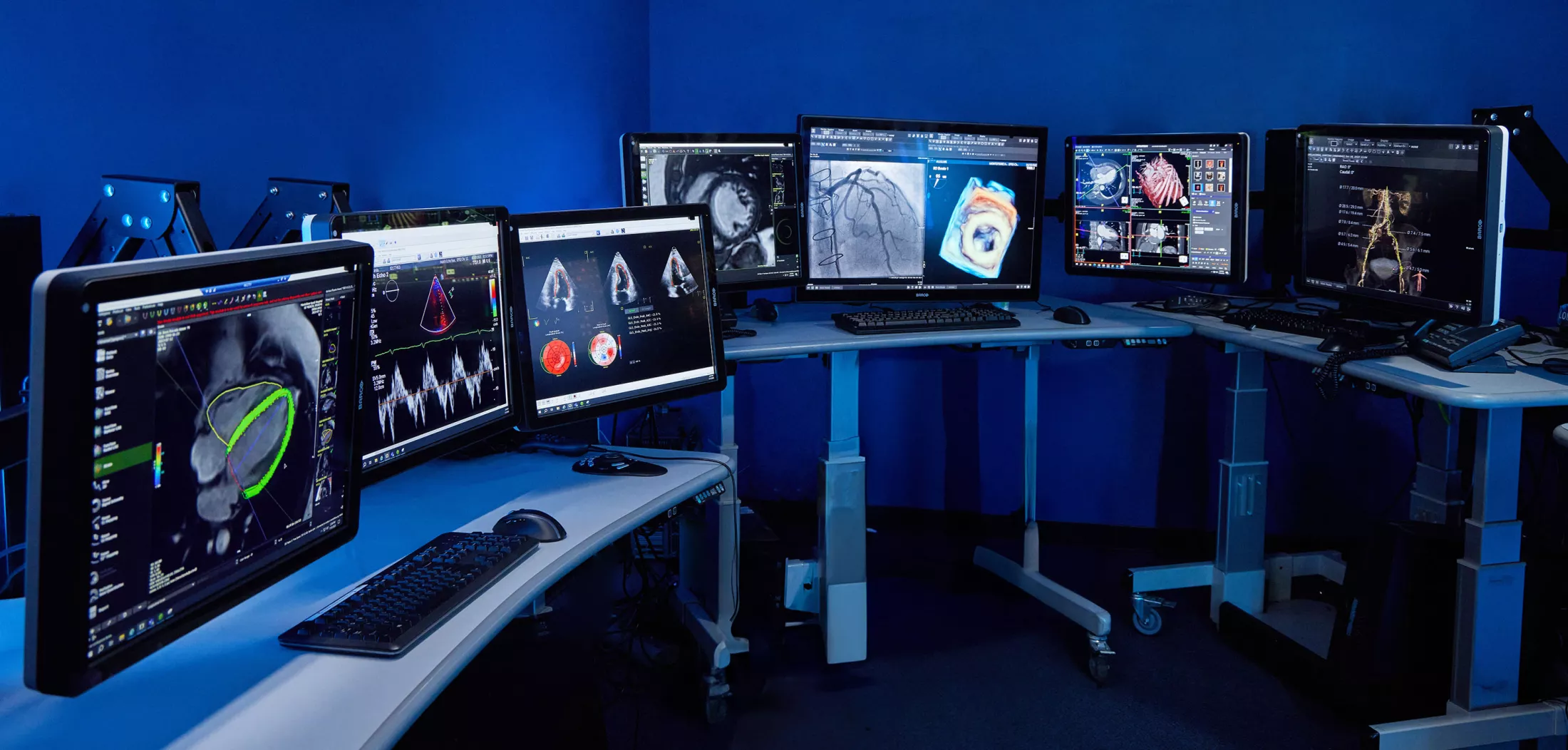 A room filled with computer screens and  monitors