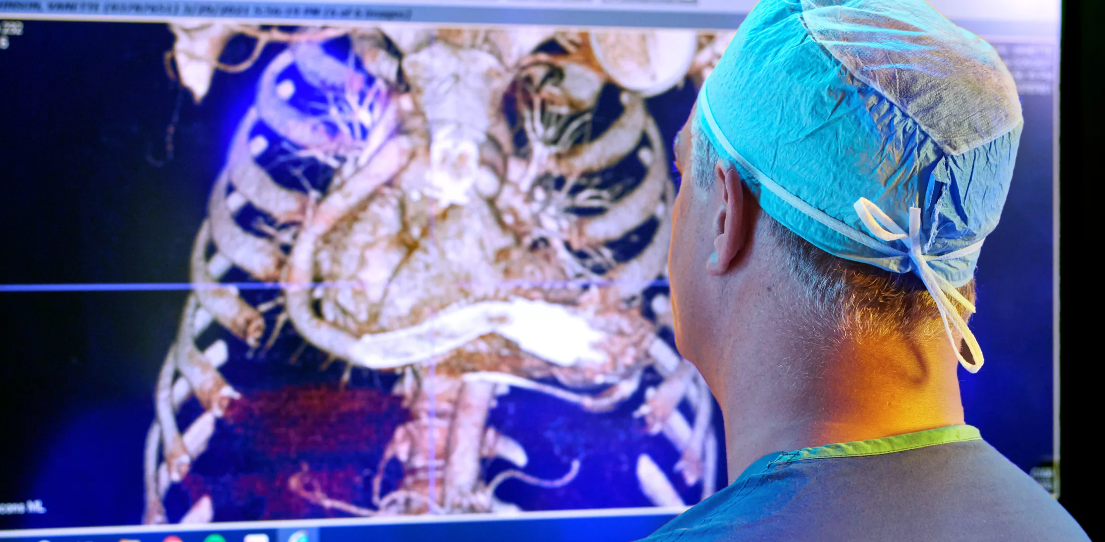 A physician looking at a monitor