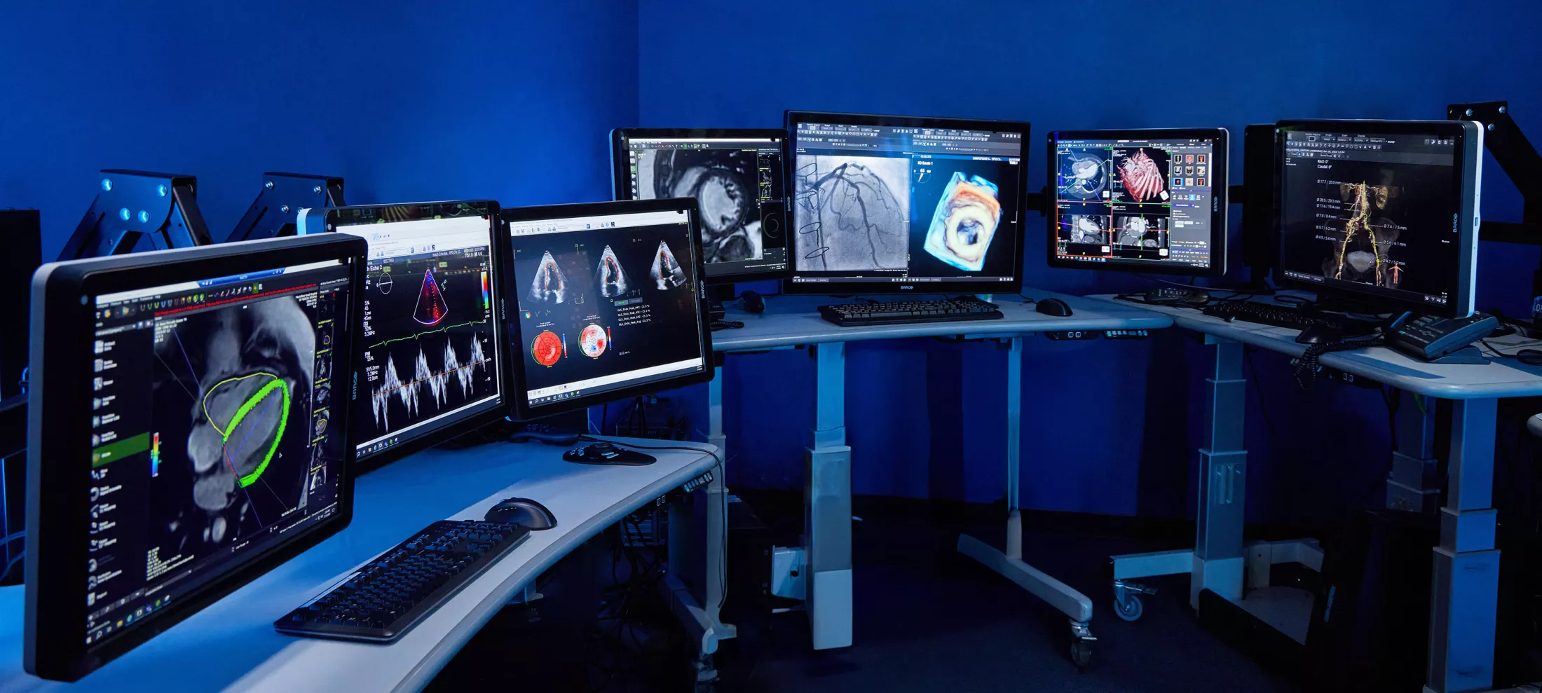 A room filled with computer screens on desks