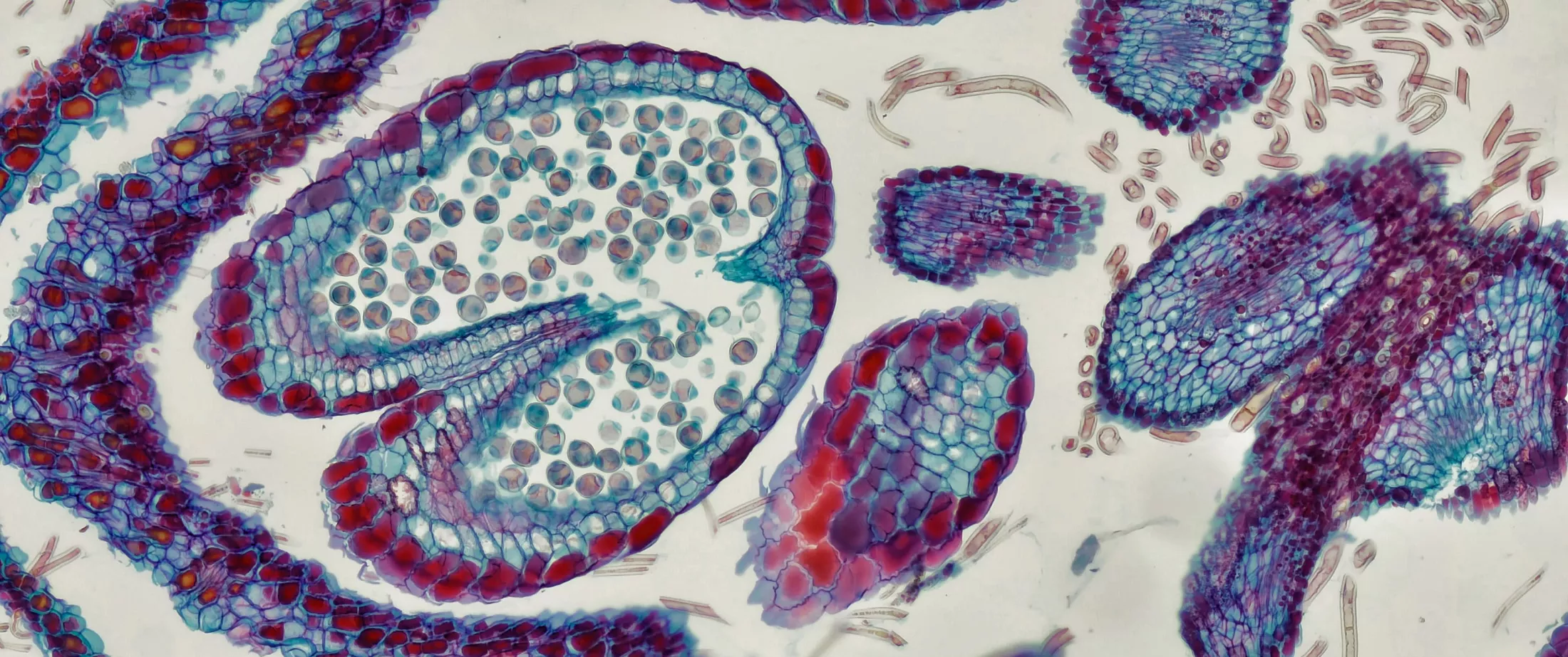 The cross section of the Cerebellum and Nerve human under a microscope.