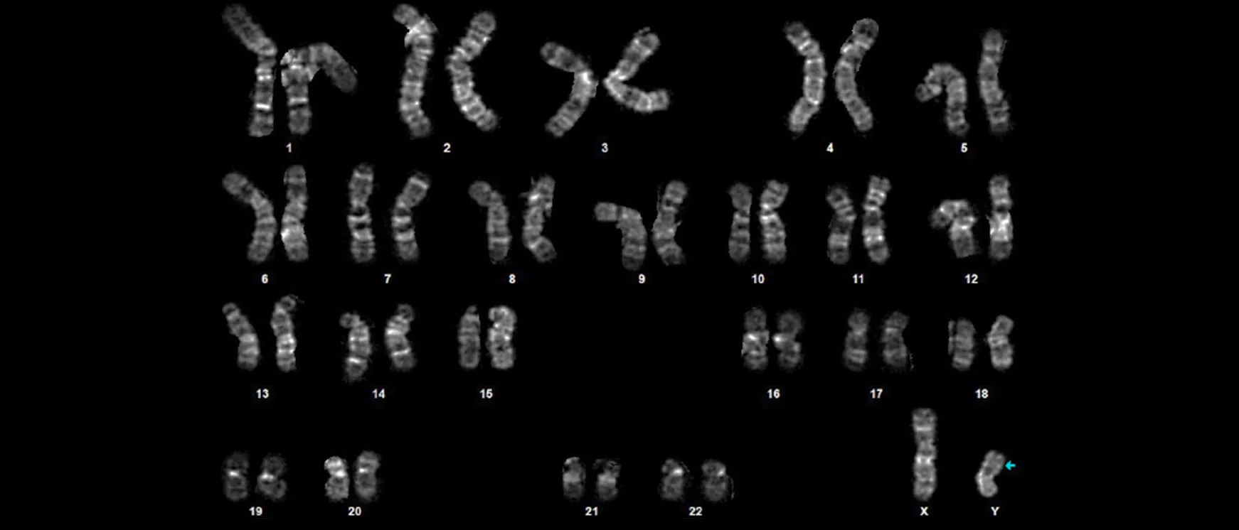  Diagram showcasing the detailed structure of a chromosome.