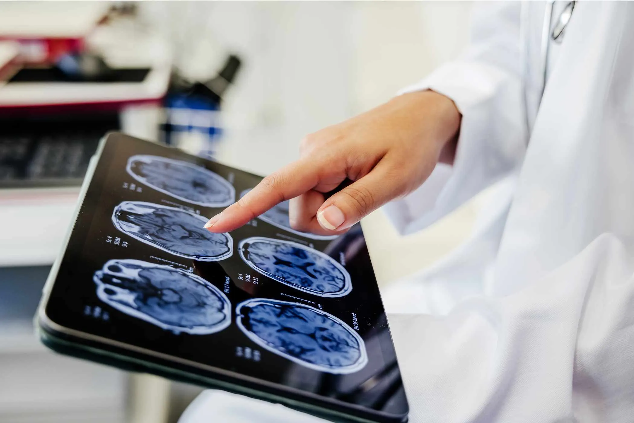 Finger pointing at brain scans on tablet