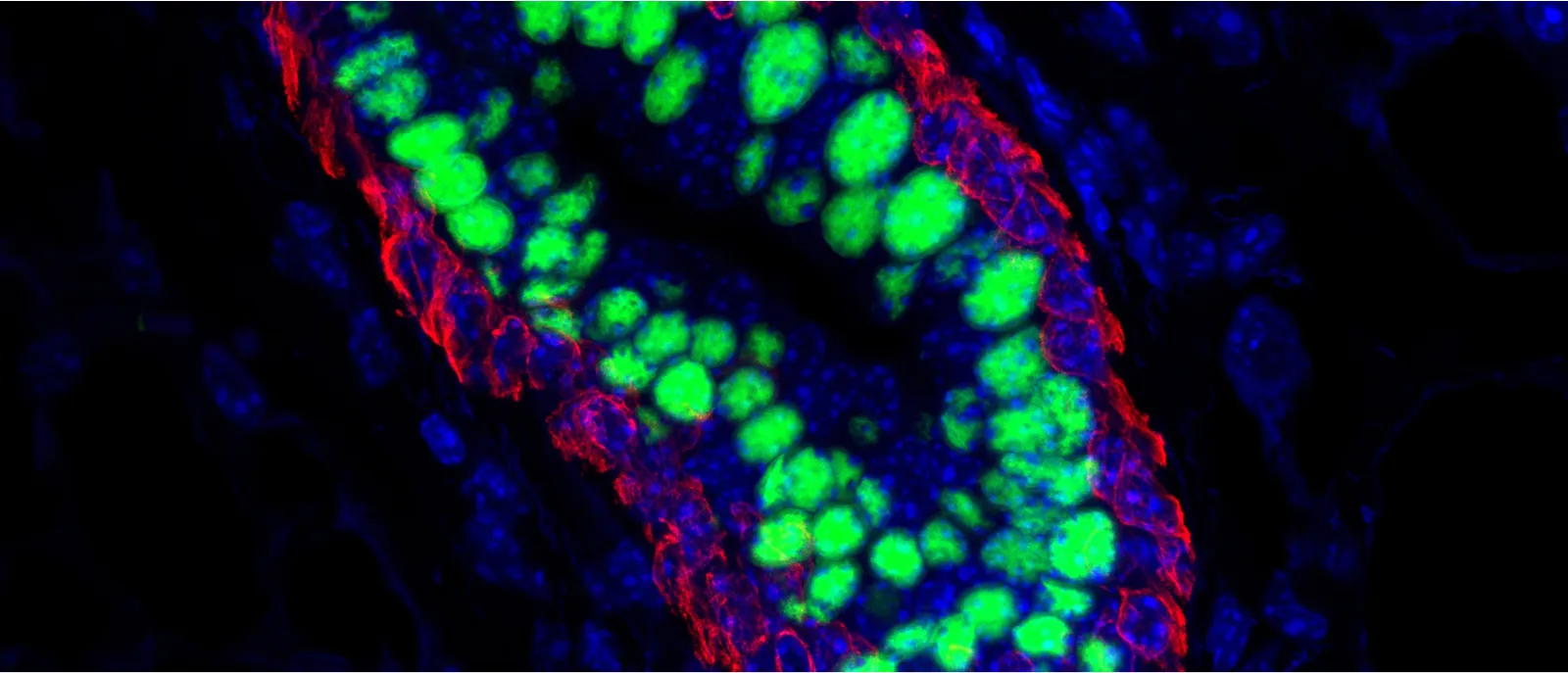 Cancer Dormancy Institute Service Core