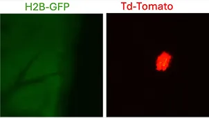 Proliferative Lesion