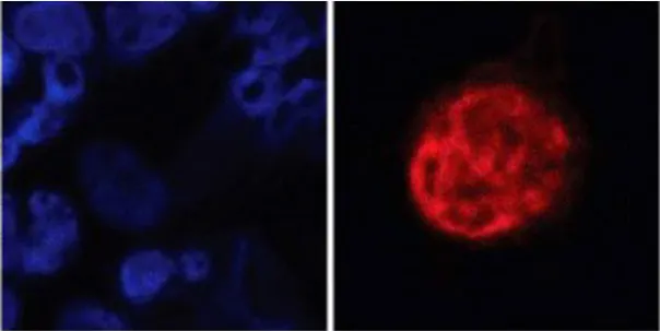 DCCs in the bone marrow of breast cancer patients