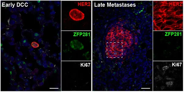 DCCs in the lungs of MMTV-HER2 mouse models
