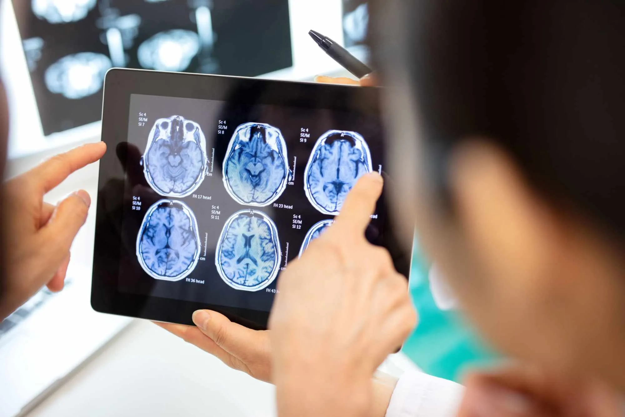 Two people looking at a brain scan on a tablet