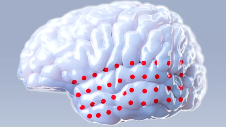 Illustration of a brain