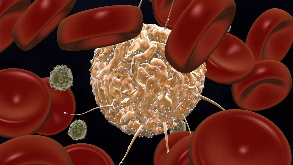 Iron Restriction Keeps Blood Stem Cells Young