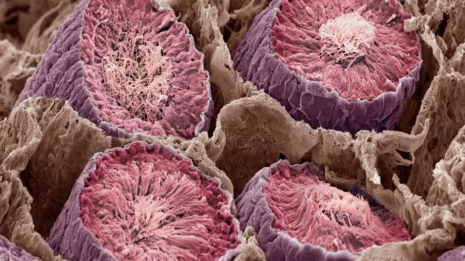 Understanding the Molecular Basis of Sperm Formation