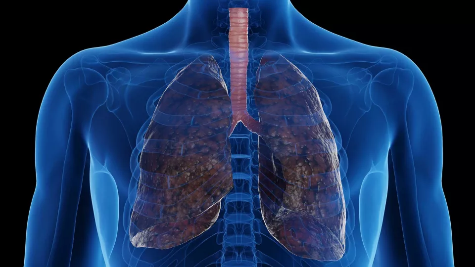 Tobacco Smoke Impacts Nearly Entire Lung Genome