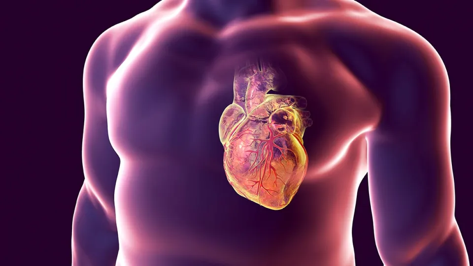 Heart Attack Conceptual Illustration