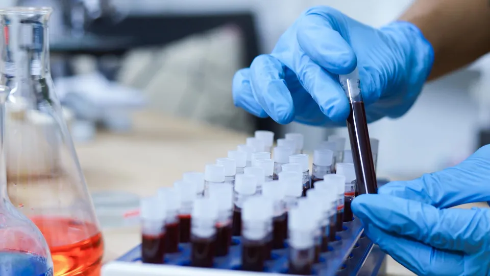 Blood research, Scientist hand holding test tube with blood in laboratory