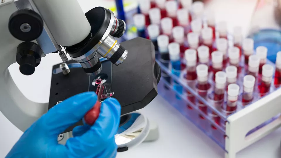 Using CAR-T Cell Therapy to Cure HIV